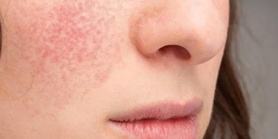 Dry Winter: How do temperature and humidity sensors help us adjust indoor humidity?